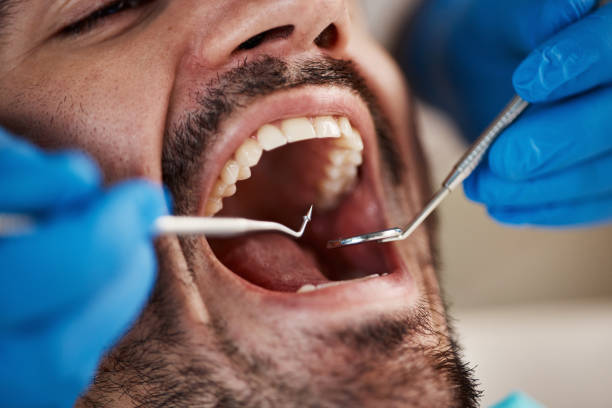 Best Tooth Extraction  in Sanford, NC